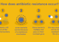 🩺 Antibiotic Resistance Threatens Safe Surgeries, Experts Warn | Rising AMR Puts Millions at Risk