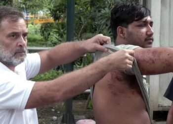Rahul Gandhi Displays Alleged Pellet Injuries of Student Protester, Calls Dharmendra Pradhan a ‘Criminal Education Minister’