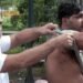 Rahul Gandhi Displays Alleged Pellet Injuries of Student Protester, Calls Dharmendra Pradhan a ‘Criminal Education Minister’