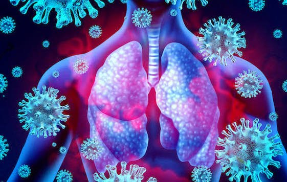 Long COVID May Alter Bacteria in the Mouth and Lungs, Study Finds; Links Seen With Brain Fog and Digestive Problems